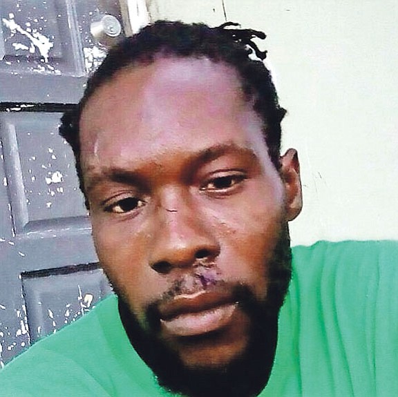 JeanRonyJean-Charles